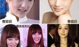 整容女星爆料事件视频,背后真相与行业乱象